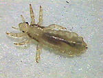 good-idea-to-cut-hair-short-louse1a.jpg